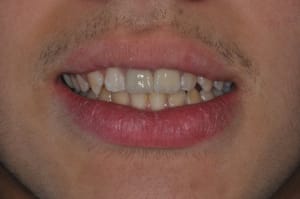 Ccc4 nkhnfo - Eugenol