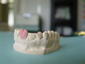 Cerec13 uxf4ru - Eugenol