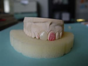 Cerec16 ew1if5 - Eugenol
