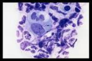 Chlamydiae jugche - Eugenol