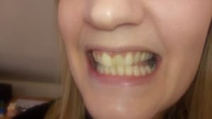 Cmvdleiho2ysvhma2xhd - Eugenol