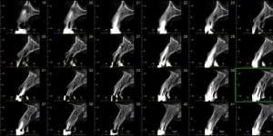 Coupes morita fffknv - Eugenol