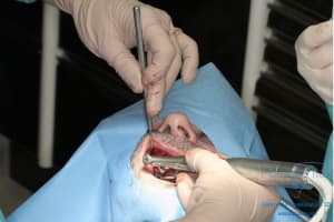 Déoulé d une mci dr r - Eugenol