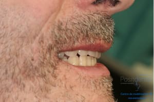 Déoulé d une mci dr r - Eugenol