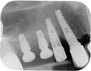 D7woy71oc1kn0ec0siftorxh32kg - Eugenol