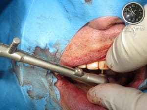 Dap659t9gl4pu83n952uhi5urex6 - Eugenol