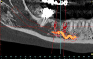 Dei b panoramic hl1tt2 - Eugenol