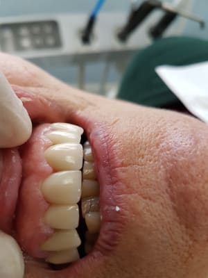 Dent0 szhcsl - Eugenol