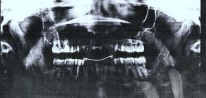 Derniere oarvwf - Eugenol