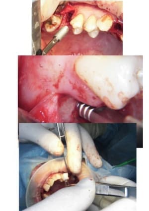 Dia4 r9fgic - Eugenol