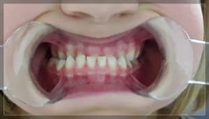 Dl5zgsbgby8ub4vi0qi0ao46dwfr - Eugenol