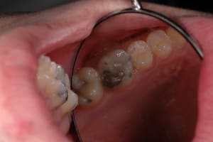 Dsc 2655 rcvrbr - Eugenol
