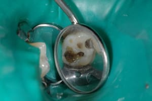 Dsc 2657 x4vox0 - Eugenol