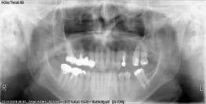 E0mgwgxugcxm6p2cmbsb - Eugenol