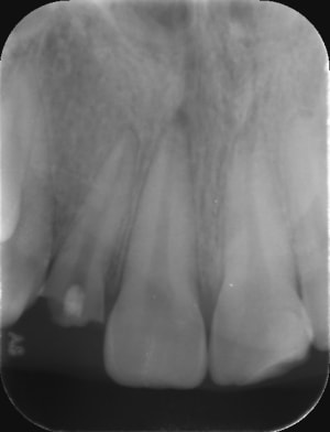 Eajj3hs7bs7ndvdod4wt - Eugenol