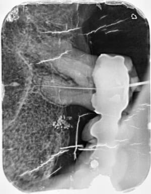 Echec eb 3 aqkcmt - Eugenol