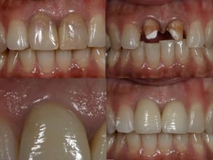 Empress pse4tr - Eugenol