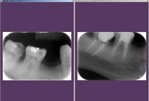 Endo1 yxkupr - Eugenol