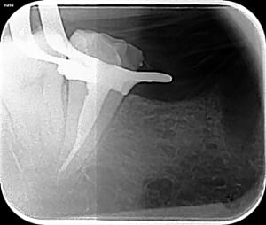 Endo 37 reyf7u - Eugenol