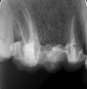 Endo fb4kc7 - Eugenol