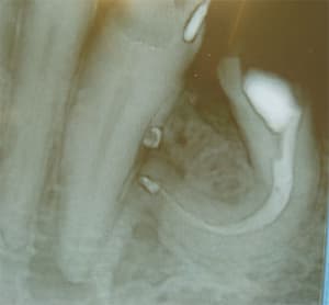 Endo n6j9nc - Eugenol