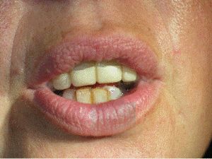 Eug01 phonetic zu37vy - Eugenol