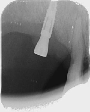 Ew302tw5k67z0t2zr1acywcdwani - Eugenol