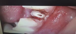 Ewxohhx3aujw0e8k9aw2hwr8njpq - Eugenol