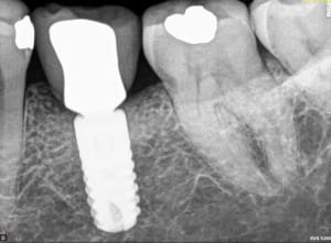 Ezrabaqi9wz8c7ei1yqild1ziyu3 - Eugenol