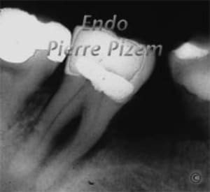 F olh avant gm6xiu - Eugenol