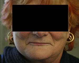Face actuel vjrx99 - Eugenol