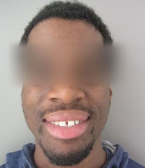 Face xucybl - Eugenol