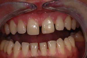 Fin eclaircissement o88ig4 - Eugenol