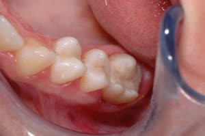 Final xwbw8w - Eugenol