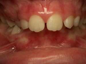 G  4  xhuron - Eugenol