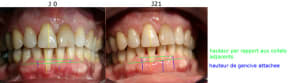Gain av ap eeycbf - Eugenol