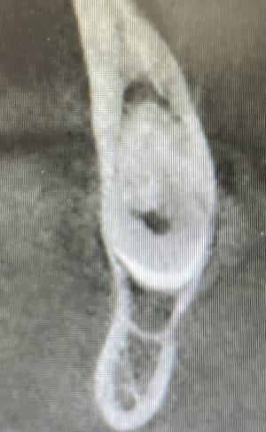 Gbd29uqs2mo4mgkblwgnx5i7fbla - Eugenol