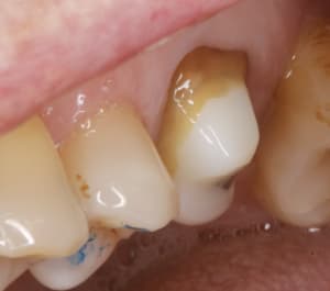 Gcaaxxnxmb68w91pnk19wy1dr5qm - Eugenol