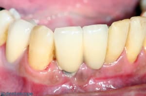 Gd fig22 zh4mtc - Eugenol