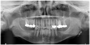 Gjuwac8cdzzirylxzz06gg0wl0bj - Eugenol