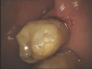 Glf3 el3bdm - Eugenol