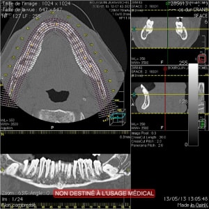 Global cad99b - Eugenol