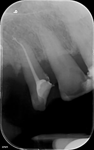Gro m65kg8 - Eugenol