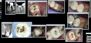 Guell s rmftfa - Eugenol