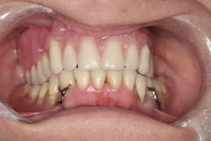 Guidage esthetique 2 oozvzu - Eugenol