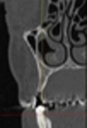 Guinm f14 thumb tngkrj - Eugenol