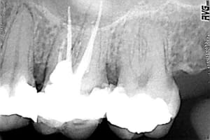 Hall y0vllq - Eugenol