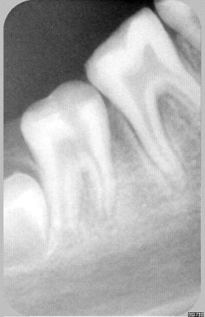 Hihi  f6hapz - Eugenol