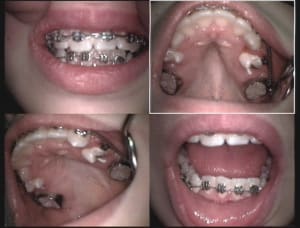 Huit mois gnxcdm - Eugenol