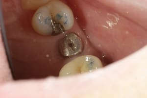 Identification xqhgmn - Eugenol